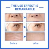 Ácido Hialurônico Anti Rugas Face Soro, B5 Anti Aging Lift, Removedor de Linhas Finas Firme, Iluminando o Círculo Escuro, A pele Ilumina, Essência - Image 7