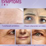Anti Rugas Efeito Instantâneo Antienvelhecimento Remove Rugas Faciais - Image 9