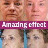 Anti Rugas Efeito Instantâneo Antienvelhecimento Remove Rugas Faciais - Image 5