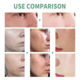 Poros encolher Remover Cravos, Acne Iluminar o Tom da Pele, Soro Facial, Refirmante, Suavizante, Hidratante, Lactose Ácido Essência - Image 3