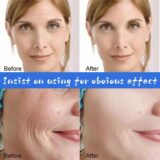 Ácido Hialurônico Anti Rugas Face Soro, B5 Anti Aging Lift, Removedor de Linhas Finas Firme, Iluminando o Círculo Escuro, A pele Ilumina, Essência - Image 6