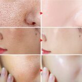 Poros encolher Remover Cravos, Acne Iluminar o Tom da Pele, Soro Facial, Refirmante, Suavizante, Hidratante, Lactose Ácido Essência - Image 2