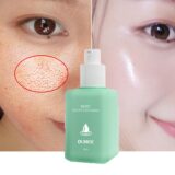 Poros encolher Remover Cravos, Acne Iluminar o Tom da Pele, Soro Facial, Refirmante, Suavizante, Hidratante, Lactose Ácido Essência - Image 7
